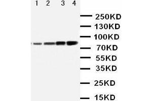 Anti-PI 3 Kinase p85 alpha antibody, Western blotting Lane 1: MCF-7 Cell Lysate Lane 2: HELA Cell Lysate Lane 3: COLO Cell Lysate Lane 4: SW620 Cell Lysate (PIK3R1 Antikörper  (N-Term))