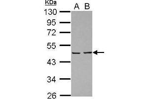 WB Image Sample (30 ug of whole cell lysate) A: A431 B: Jurkat 10% SDS PAGE antibody diluted at 1:10000 (PA2G4 Antikörper)