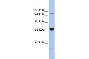 WB Suggested Anti-KIF15 Antibody Titration:  0. (KIF15 Antikörper  (Middle Region))