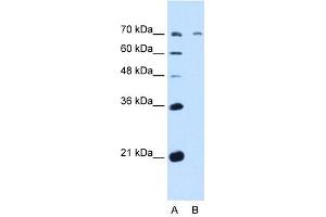 GALNT6 antibody used at 5 ug/ml to detect target protein. (GALNT6 Antikörper  (N-Term))