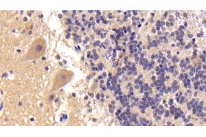 Detection of IGF1 in Human Cerebellum Tissue using Monoclonal Antibody to Insulin Like Growth Factor 1 (IGF1) (IGF1 Antikörper  (AA 49-118))
