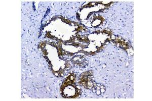 IHC analysis of NMI using anti-NMI antibody (ABIN3043451). (NMI Antikörper  (AA 2-307))