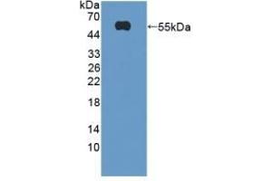 Detection of Recombinant TREM2, Mouse using Polyclonal Antibody to Triggering Receptor Expressed On Myeloid Cells 2 (TREM2) (TREM2 Antikörper  (AA 1-227))