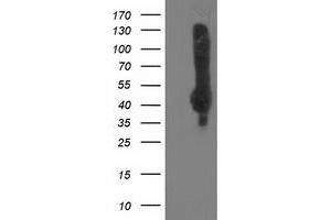 Western Blotting (WB) image for anti-Sialidase 2 (Cytosolic Sialidase) (NEU2) antibody (ABIN1499694) (NEU2 Antikörper)