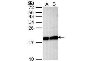 Western Blotting (WB) image for anti-Ubiquitin-Conjugating Enzyme E2L 3 (UBE2L3) (C-Term) antibody (ABIN2855918)