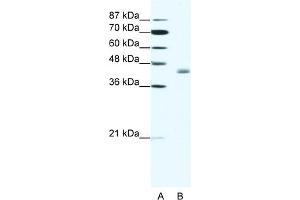 WB Suggested Anti-LDB2 Antibody Titration:  1.