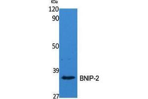 Western Blot (WB) analysis of specific cells using BNIP-2 Polyclonal Antibody. (BNIP2 Antikörper  (Internal Region))