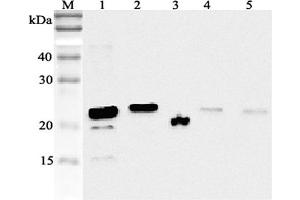 Western blot analysis using anti-RBP4 (human), pAb  at 1:2'000 dilution.