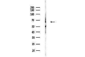 Western blot analysis of lysates from HepG2 cells(heat-shock,45 min treatment), using ELP3 Antibody at 1/1000 dilution.