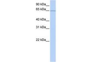 Image no. 1 for anti-Pumilio RNA Binding Family Member 3 (PUM3) (AA 451-500) antibody (ABIN6740662) (KIAA0020 Antikörper  (AA 451-500))