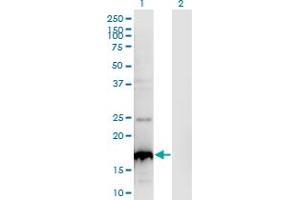 Western Blot analysis of BLOC1S2 expression in transfected 293T cell line by BLOC1S2 monoclonal antibody (M01), clone 8C10.