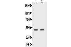 Anti-CD2 antibody, Western blotting Lane 1: Rat Spleen Cell Lysate Lane 2: NIH/3T3 Cell Lysate (CD2 Antikörper  (Middle Region))