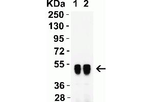 Western Blot Validation with Human Recombinant Protein. (SARS-CoV-2 Nucleocapsid Antikörper)