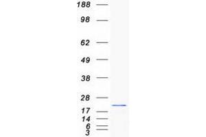 Western Blotting (WB) image for Methionine Sulfoxide Reductase B2 (MSRB2) protein (Myc-DYKDDDDK Tag) (ABIN2726470)