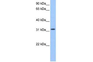 anti-Zinc Finger, C2HC-Type Containing 1C (ZC2HC1C) (N-Term) antibody