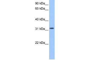 WB Suggested Anti-C14orf140 Antibody Titration: 0. (ZC2HC1C Antikörper  (N-Term))