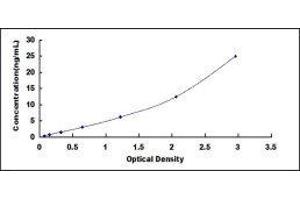 ELISA image for beta-2-Microglobulin (B2M) ELISA Kit (ABIN414956)