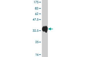 Western Blot detection against Immunogen (33. (ATOX1 Antikörper  (AA 1-68))