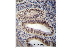 Immunohistochemistry (Paraffin-embedded Sections) (IHC (p)) image for anti-Progesterone Receptor (PGR) (AA 349-377) antibody (ABIN656981)