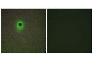 Immunofluorescence analysis of A549 cells, using HIPK4 antibody. (HIPK4 Antikörper  (C-Term))
