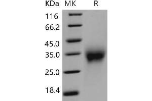 Western Blotting (WB) image for Activin RIIA / ACVR2A (Active) protein (His tag) (ABIN7194139)
