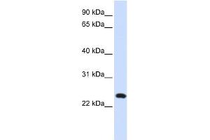 WB Suggested Anti-C20orf103 Antibody Titration:  0. (LAMP5 Antikörper  (Middle Region))