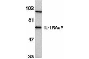 Western blot analysis of IL-1RAcP in HeLa whole cell lysate with AP30412PU-N IL-1RAcP antibody at 1/500 dilution. (FBXO43 Antikörper  (C-Term))