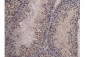 DAB staining on IHC-P; Samples: Mouse Testis Tissue (STAT1 Antikörper  (AA 432-680))