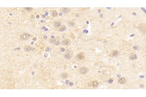 Immunohistochemistry (IHC) image for anti-Cholinergic Receptor, Nicotinic, alpha 4 (CHRNA4) (AA 49-242) antibody (ABIN7444463)