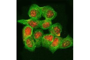IF analysis of RNASEH2B using anti-RNASEH2B antibody (ABIN7601572) and anti-Tubulin Alpha antibody (ABIN7600339).