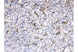 IHC analysis of Bax using anti-Bax antibody . (BAX Antikörper  (N-Term))