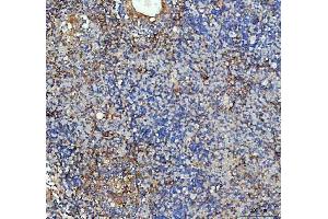 IHC analysis of ICAM1 using anti-ICAM1 antibody (ABIN5692991). (ICAM1 Antikörper  (AA 28-268))