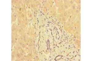 Immunohistochemistry of paraffin-embedded human liver tissue using ABIN7165948 at dilution of 1:100 (PPM1H Antikörper  (AA 73-289))