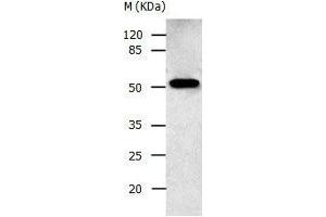 Gel: 10 % SDS-PAGE Lysate: 30 μg Human fetal brain tissue lysate Primary antibody: 1/500 dilution Secondary antibody: Donkey anti Rabbit IgG - H&L (HRP) at 1/3000 dilution Exposure time: 30 seconds (AAK1 Antikörper  (N-Term))