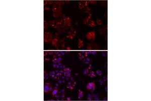 Immunofluorescence analysis of SW480 cells showing nuclear and cytoplasmic localization with NOTCH3 antibody 1:200 (top,red). (NOTCH3 Antikörper)