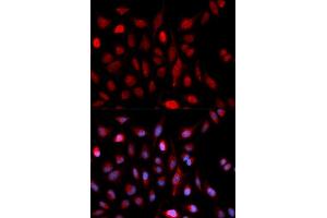 Immunofluorescence (IF) image for anti-Set1/Ash2 Histone Methyltransferase Complex Subunit ASH2 (ASH2L) antibody (ABIN1876580) (ASH2L Antikörper)