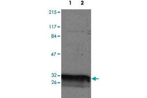 Western blot analysis of YWHAQ expression in HeLa (Lane 1) and Jurkat (Lane 2) whole cell lysates. (14-3-3 theta Antikörper)