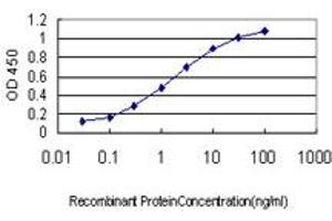 Detection limit for recombinant GST tagged IRAK2 is approximately 0. (IRAK2 Antikörper  (AA 111-210))