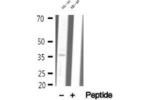 Western blot analysis of extracts of HL-60 cells, using MDH1 antibody. (MDH1 Antikörper  (C-Term))