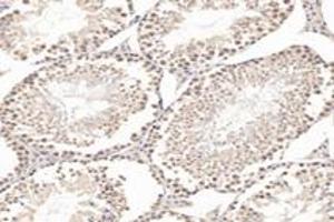 Immunohistochemistry (Paraffin-embedded Sections) (IHC (p)) image for anti-T-Box 19 (TBX19) antibody (ABIN7075815)