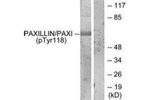 Western blot analysis of extracts from HeLa cells treated with EGF, using Paxillin (Phospho-Tyr118) Antibody. (Paxillin Antikörper  (pTyr118))