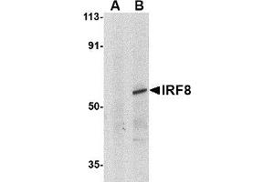 Western blot analysis of IRF8 in human thymus tissue lysate with AP30451PU-N IRF8 antibody at 1μg/ml in (A) the presence and (B) absence of blocking peptide. (IRF8 Antikörper)