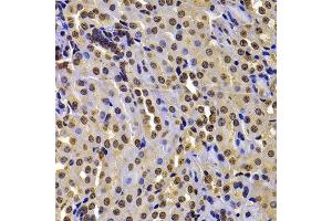 Immunohistochemistry of paraffin-embedded mouse kidney using WHSC1 antibody at dilution of 1:100 (40x lens).