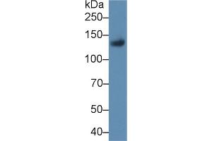 Western blot analysis of Rat Placenta lysate, using Rat LIFR Antibody (1 µg/ml) and HRP-conjugated Goat Anti-Rabbit antibody ( (LIFR Antikörper  (AA 642-791))