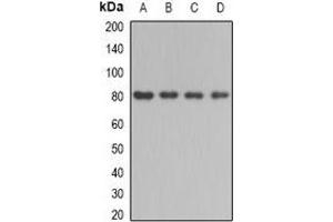 Western blot analysis of BBS2 expression in mouse testis (A), mouse kidney (B), rat liver (C), rat brain (D) whole cell lysates. (BBS2 Antikörper)