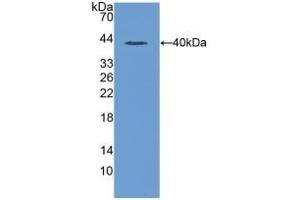Detection of Recombinant MIP1a, Rat using Polyclonal Antibody to Macrophage Inflammatory Protein 1 Alpha (MIP1a) (CCL3 Antikörper  (AA 24-92))