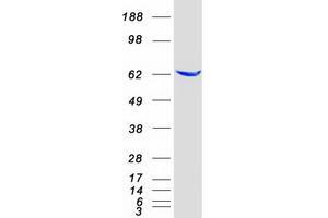 Western Blotting (WB) image for Epoxide Hydrolase 2, Cytoplasmic (EPHX2) protein (Myc-DYKDDDDK Tag) (ABIN2720336)