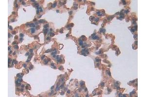 DAB staining on IHC-P; Samples: Rat Lung Tissue (LCNL1 Antikörper  (AA 2-164))
