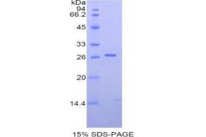SDS-PAGE analysis of Human SIGLEC2 Protein. (CD22 Protein)