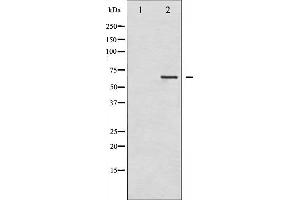 Western Blotting (WB) image for anti-LIM Domain Kinase 2 (LIMK2) (pSer283) antibody (ABIN6256239)